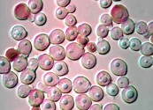 El desconocido papel de los hongos en la microbiota humana: en la salud y en la enfermedad